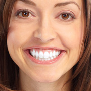 Teeth Whitening